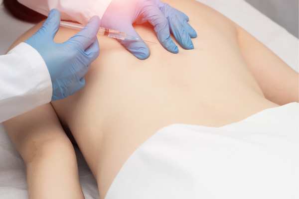 Lipo Sculpt will offer the best fat back reduction Cumbernauld  call us today!