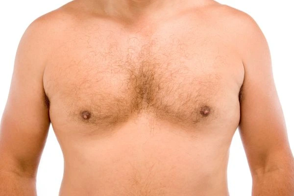 Fat freezing for moobs reduction treatment Cumbernauld  book in today!