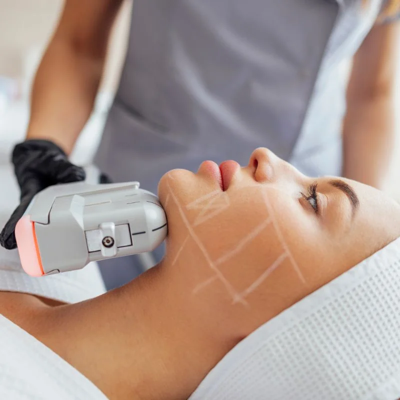HIFU non surgical treatment Cumbernauld 